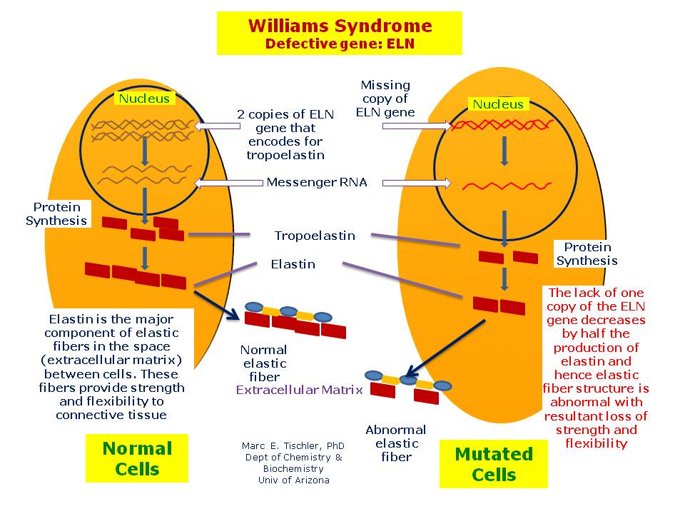 Williams Syndrome | Hereditary Ocular Diseases